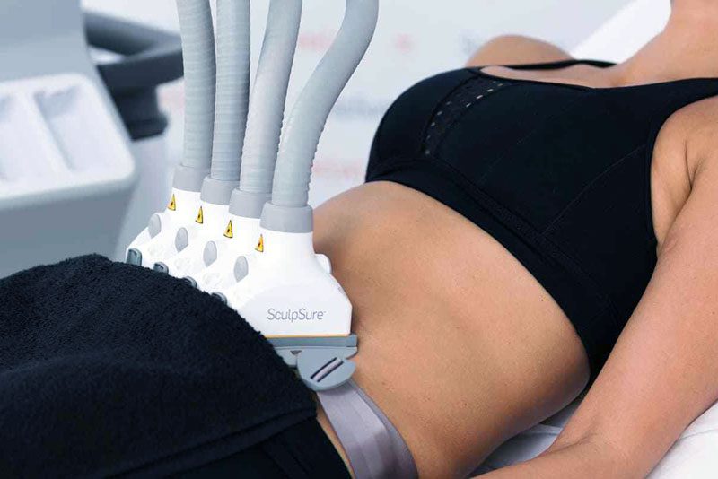 Radio Frequency Body Contouring